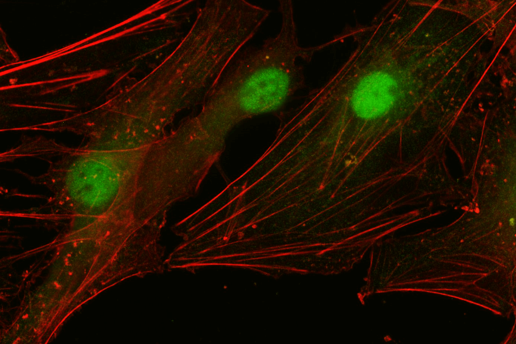 inflammation cells millifluidic react4life