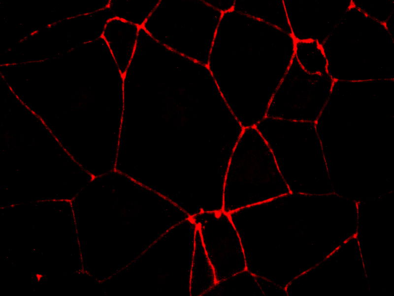 Epithelial Integrity Tight Junction